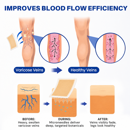 Yellowou® 𝑽𝗲𝗶𝙣 𝘾𝐨𝐧𝘁𝗼𝙪𝙧 𝙈𝙞𝐜𝐫𝒐𝒏𝒆𝗲𝗱𝗹𝙚 𝙋𝙖𝐭𝐜𝒉 𝒘𝒊𝘁𝗵 𝗔𝙙𝙫𝙖𝙣𝙘𝐞𝐝 𝐃𝒊𝒐𝒔𝗺𝙞𝐧 & 𝑯𝒆𝘀𝗽𝗲𝙧𝙞𝙙𝙞𝐧 𝐃𝒆𝒍𝒊𝒗𝗲𝗿𝙮🌿𝟕-𝐃𝐚𝐲 𝐕𝐢𝐬𝐢𝐛𝐥𝐞 𝐑𝐞𝐬𝐮𝐥𝐭𝐬 𝐟𝐨𝐫 𝐕𝐚𝐫𝐢𝐜𝐨𝐬𝐞 𝐕𝐞𝐢𝐧𝐬