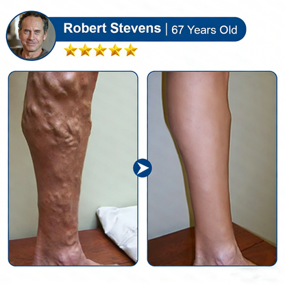 Yellowou® 𝑽𝗲𝗶𝙣 𝘾𝐨𝐧𝘁𝗼𝙪𝙧 𝙈𝙞𝐜𝐫𝒐𝒏𝒆𝗲𝗱𝗹𝙚 𝙋𝙖𝐭𝐜𝒉 𝒘𝒊𝘁𝗵 𝗔𝙙𝙫𝙖𝙣𝙘𝐞𝐝 𝐃𝒊𝒐𝒔𝗺𝙞𝐧 & 𝑯𝒆𝘀𝗽𝗲𝙧𝙞𝙙𝙞𝐧 𝐃𝒆𝒍𝒊𝒗𝗲𝗿𝙮🌿𝟕-𝐃𝐚𝐲 𝐕𝐢𝐬𝐢𝐛𝐥𝐞 𝐑𝐞𝐬𝐮𝐥𝐭𝐬 𝐟𝐨𝐫 𝐕𝐚𝐫𝐢𝐜𝐨𝐬𝐞 𝐕𝐞𝐢𝐧𝐬
