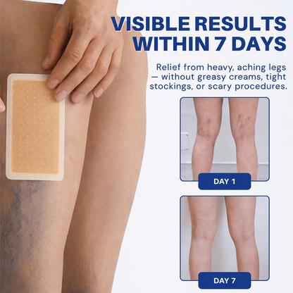 Yellowou® 𝑽𝗲𝗶𝙣 𝘾𝐨𝐧𝘁𝗼𝙪𝙧 𝙈𝙞𝐜𝐫𝒐𝒏𝒆𝗲𝗱𝗹𝙚 𝙋𝙖𝐭𝐜𝒉 𝒘𝒊𝘁𝗵 𝗔𝙙𝙫𝙖𝙣𝙘𝐞𝐝 𝐃𝒊𝒐𝒔𝗺𝙞𝐧 & 𝑯𝒆𝘀𝗽𝗲𝙧𝙞𝙙𝙞𝐧 𝐃𝒆𝒍𝒊𝒗𝗲𝗿𝙮🌿𝟕-𝐃𝐚𝐲 𝐕𝐢𝐬𝐢𝐛𝐥𝐞 𝐑𝐞𝐬𝐮𝐥𝐭𝐬 𝐟𝐨𝐫 𝐕𝐚𝐫𝐢𝐜𝐨𝐬𝐞 𝐕𝐞𝐢𝐧𝐬