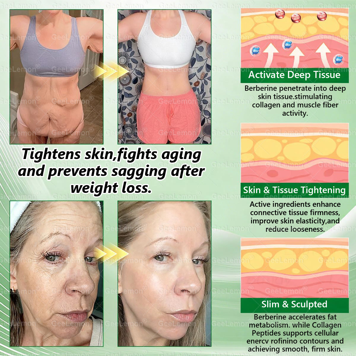 ⭐𝐆𝐞𝐞𝐋𝐞𝐦𝐨𝐧® 𝐌𝐨𝐫𝐢𝗻𝗴𝗮 · 𝐁𝐞𝐫𝐛𝗲𝗿𝗶𝗻𝗲 × 𝗡𝗔𝗗+ 𝟏𝟎 𝐢𝐧 𝟏 𝐀𝐝𝐯𝐚𝐧𝐜𝐞𝐝 𝗡𝗮𝗻𝗼 𝗠𝗶𝗰𝗿𝗼𝗻𝐞𝐞𝐝𝐥𝐞 𝐏𝐚𝐭𝗰𝗵👩‍⚕️👩‍⚕️(Just once a day, visible changes in 7 days) ✅ For obesity, loose skin, diabetes, and more.