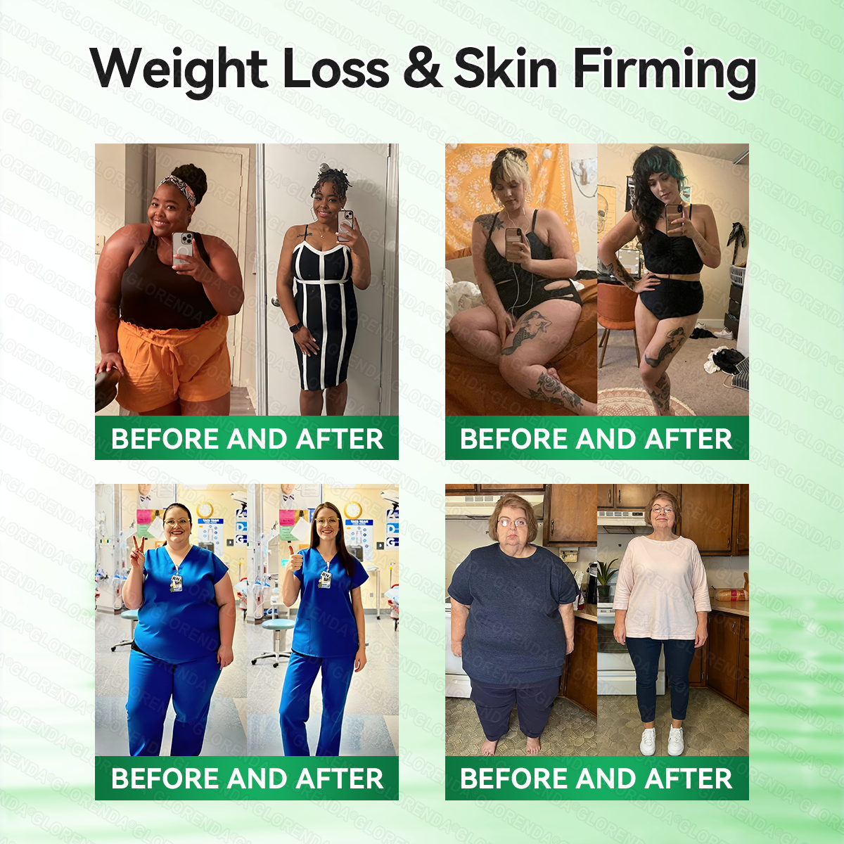 𝑶𝒇𝒇𝒊𝒄𝒊𝒂𝒍 𝑺𝒕𝒐𝒓𝒆  |💯💯𝐂𝐚𝐫𝐞𝐔𝐩𝐥𝐢𝐟𝐭® 𝑴𝒐𝒓𝒊𝒏𝒈𝗮 · 𝗕𝗲𝗿𝗯𝗲𝗿𝙞𝙣𝙚 × 𝙉𝘼𝐃+ 𝟏𝟎-𝐢𝐧-𝟏 𝗔𝗱𝘃𝗮𝗻𝗰𝙚𝙙 𝙉𝙖𝙣𝙤 𝙈𝙞𝙘𝙧𝙤𝙣𝙚𝙚𝐝𝐥𝐞 𝐏𝐚𝐭𝙘𝙝🇺🇸(𝐉𝐮𝐬𝐭 𝐨𝐧𝐜𝐞 𝐚 𝐝𝐚𝐲, 𝐯𝐢𝐬𝐢𝐛𝐥𝐞 𝐜𝐡𝐚𝐧𝐠𝐞𝐬 𝐢𝐧 𝟕 𝐝𝐚𝐲𝐬） ✅ 𝐅𝐨𝐫 𝐨𝐛𝐞𝐬𝐢𝐭𝐲, 🅛🅞🅞🅢🅔 🅢🅚🅘🅝,𝐝𝐢𝐚𝐛𝐞𝐭𝐞𝐬, 𝐬𝐥𝐞𝐞𝐩 𝐚𝐩𝐧𝐞𝐚, 𝐣𝐨𝐢𝐧𝐭 𝐢𝐬𝐬𝐮𝐞𝐬, 𝐚𝐧𝐝 𝐦𝐨𝐫𝐞💯💯