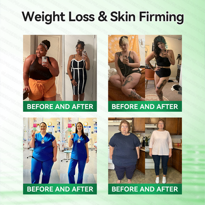 𝑶𝒇𝒇𝒊𝒄𝒊𝒂𝒍 𝑺𝒕𝒐𝒓𝒆  |💯💯𝐂𝐚𝐫𝐞𝐔𝐩𝐥𝐢𝐟𝐭® 𝑴𝒐𝒓𝒊𝒏𝒈𝗮 · 𝗕𝗲𝗿𝗯𝗲𝗿𝙞𝙣𝙚 × 𝙉𝘼𝐃+ 𝟏𝟎-𝐢𝐧-𝟏 𝗔𝗱𝘃𝗮𝗻𝗰𝙚𝙙 𝙉𝙖𝙣𝙤 𝙈𝙞𝙘𝙧𝙤𝙣𝙚𝙚𝐝𝐥𝐞 𝐏𝐚𝐭𝙘𝙝🇺🇸(𝐉𝐮𝐬𝐭 𝐨𝐧𝐜𝐞 𝐚 𝐝𝐚𝐲, 𝐯𝐢𝐬𝐢𝐛𝐥𝐞 𝐜𝐡𝐚𝐧𝐠𝐞𝐬 𝐢𝐧 𝟕 𝐝𝐚𝐲𝐬） ✅ 𝐅𝐨𝐫 𝐨𝐛𝐞𝐬𝐢𝐭𝐲, 🅛🅞🅞🅢🅔 🅢🅚🅘🅝,𝐝𝐢𝐚𝐛𝐞𝐭𝐞𝐬, 𝐬𝐥𝐞𝐞𝐩 𝐚𝐩𝐧𝐞𝐚, 𝐣𝐨𝐢𝐧𝐭 𝐢𝐬𝐬𝐮𝐞𝐬, 𝐚𝐧𝐝 𝐦𝐨𝐫𝐞💯💯