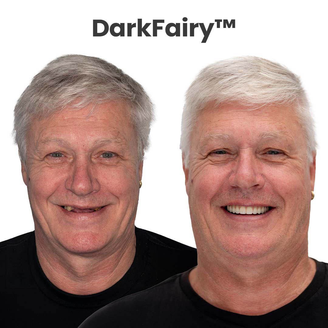 🦷 DarkFairy™ Custom-Fit Dentures 🦷 ENDS TODAY   70% OFF | Smile with Confidence